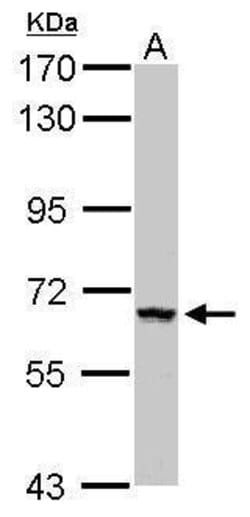 Invitrogen ZNF34 Polyclonal Antibody 100 &mu;L; Unconjugated:Antibodies,