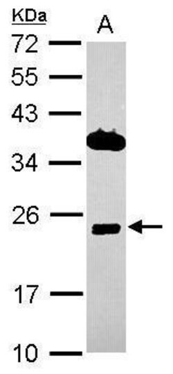 Invitrogen ITM2C Polyclonal Antibody 100 &mu;L; Unconjugated:Antibodies,