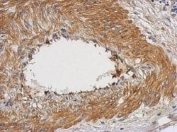 Invitrogen NUAK2 Polyclonal Antibody 100 &mu;L; Unconjugated:Antibodies,