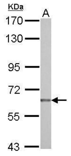 Invitrogen NUAK2 Polyclonal Antibody 100 &mu;L; Unconjugated:Antibodies,