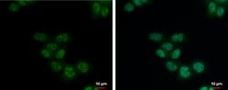 Invitrogen SETDB2 Polyclonal Antibody 100 &mu;L; Unconjugated:Antibodies,