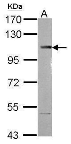 Invitrogen SETDB2 Polyclonal Antibody 100 &mu;L; Unconjugated:Antibodies,