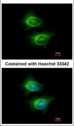 Invitrogen ASCC2 Polyclonal Antibody 100 &mu;L; Unconjugated:Antibodies,