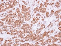 Invitrogen ASCC2 Polyclonal Antibody 100 &mu;L; Unconjugated:Antibodies,