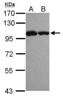 Invitrogen ASCC2 Polyclonal Antibody 100 &mu;L; Unconjugated:Antibodies,