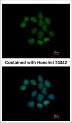 Invitrogen C1orf57 Polyclonal Antibody 100 &mu;L | Buy Online | Invitrogen&trade; | Fisher Scientific