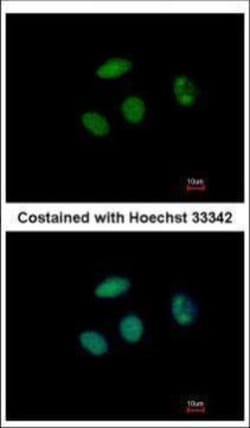Invitrogen PHF6 Polyclonal Antibody 100 &mu;L; Unconjugated:Antibodies,