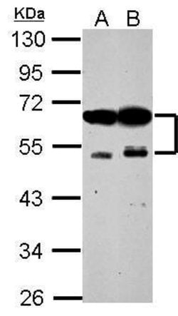 Invitrogen ZFYVE19 Polyclonal Antibody 100 &mu;L; Unconjugated:Antibodies,