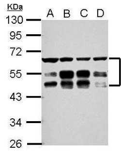 Invitrogen ZFYVE19 Polyclonal Antibody 100 &mu;L; Unconjugated:Antibodies,