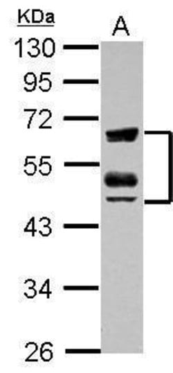 Invitrogen ZFYVE19 Polyclonal Antibody 100 &mu;L; Unconjugated:Antibodies,