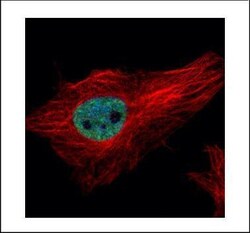 Invitrogen PPIL4 Polyclonal Antibody 100 &mu;L | Buy Online | Invitrogen&trade; | Fisher Scientific