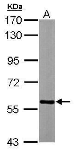 Invitrogen TBLR1 Polyclonal Antibody 100 &mu;L; Unconjugated:Antibodies,