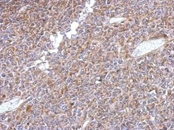 Invitrogen KLHL1 Polyclonal Antibody 100 &mu;L; Unconjugated:Antibodies,