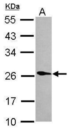 Invitrogen PLA2G12A Polyclonal Antibody 100 &mu;L; Unconjugated:Antibodies,