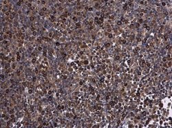 Invitrogen KIF13A Polyclonal Antibody 100 &mu;L; Unconjugated:Antibodies,