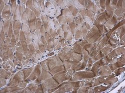 Invitrogen KIF13A Polyclonal Antibody 100 &mu;L; Unconjugated:Antibodies,
