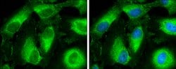 Invitrogen CYP3A43 Polyclonal Antibody 100 &mu;L; Unconjugated:Antibodies,