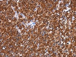 Invitrogen RGS6 Polyclonal Antibody 100 &mu;L; Unconjugated:Antibodies,