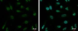 Invitrogen ZNF189 Polyclonal Antibody 100 &mu;L; Unconjugated:Antibodies,