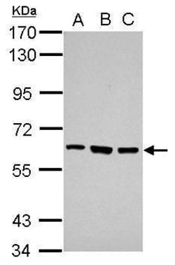 Invitrogen ZNF189 Polyclonal Antibody 100 &mu;L; Unconjugated:Antibodies,