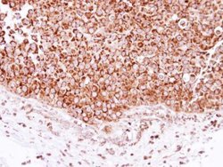 Invitrogen DECR1 Polyclonal Antibody 100 &mu;L; Unconjugated:Antibodies,