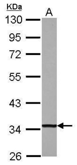 Invitrogen DECR1 Polyclonal Antibody 100 &mu;L; Unconjugated:Antibodies,
