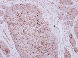Invitrogen ZP2 Polyclonal Antibody 100 &mu;L; Unconjugated:Antibodies,