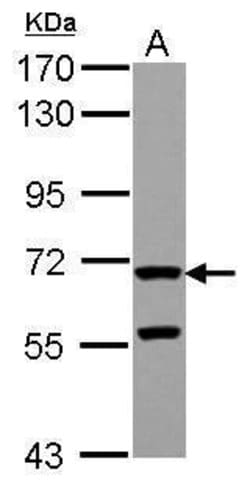 Invitrogen ZP2 Polyclonal Antibody 100 &mu;L; Unconjugated:Antibodies,
