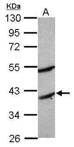 Invitrogen MOGAT2 Polyclonal Antibody 100 &mu;L; Unconjugated:Antibodies,