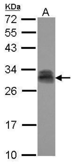 PTTG2 Polyclonal Antibody, Invitrogen™