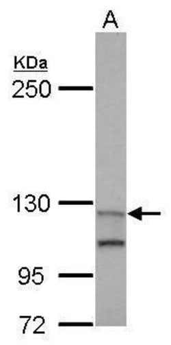 Invitrogen Munc13-4 Polyclonal Antibody 100 &mu;L | Buy Online | Invitrogen&trade; | Fisher Scientific