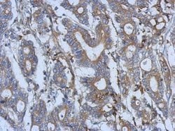 Invitrogen SEMA5A Polyclonal Antibody 100 &mu;L; Unconjugated:Antibodies,