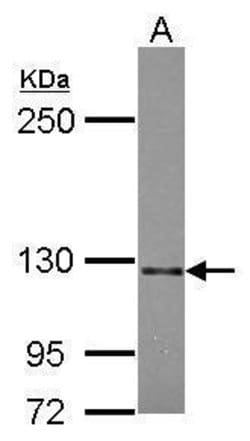 Invitrogen SEMA5A Polyclonal Antibody 100 &mu;L; Unconjugated:Antibodies,
