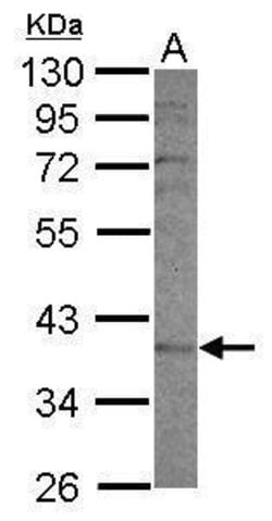 Invitrogen CYP2F1 Polyclonal Antibody 100 &mu;L | Buy Online | Invitrogen&trade; | Fisher Scientific