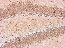 Invitrogen NFIX Polyclonal Antibody 100 &mu;L; Unconjugated:Antibodies,