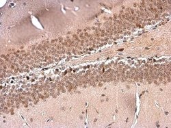 Invitrogen NFIX Polyclonal Antibody 100 &mu;L; Unconjugated:Antibodies,