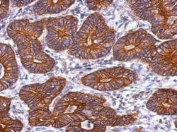 Invitrogen KRT72 Polyclonal Antibody 100 &mu;L; Unconjugated:Antibodies,