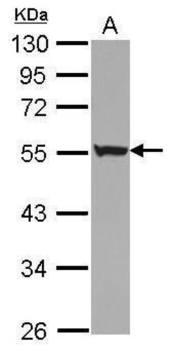 Invitrogen KRT72 Polyclonal Antibody 100 &mu;L; Unconjugated:Antibodies,