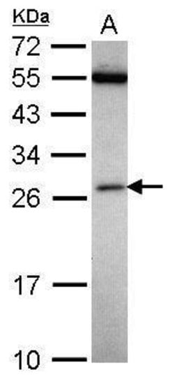 Invitrogen FAAP24 Polyclonal Antibody 100 &mu;L; Unconjugated:Antibodies,