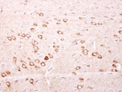 Invitrogen FTMT Polyclonal Antibody 100 &mu;L; Unconjugated:Antibodies,