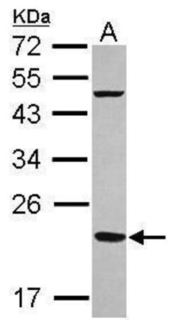 Invitrogen FTMT Polyclonal Antibody 100 &mu;L; Unconjugated:Antibodies,