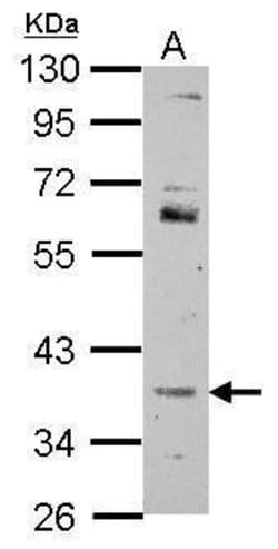 FOXR2 Polyclonal Antibody, Invitrogen&trade; 100 &mu;L; Unconjugated 