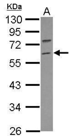 Invitrogen RNF36 Polyclonal Antibody 100 &mu;L | Buy Online | Invitrogen&trade; | Fisher Scientific