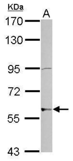 Invitrogen ZNF596 Polyclonal Antibody 100 &mu;L | Buy Online | Invitrogen&trade; | Fisher Scientific