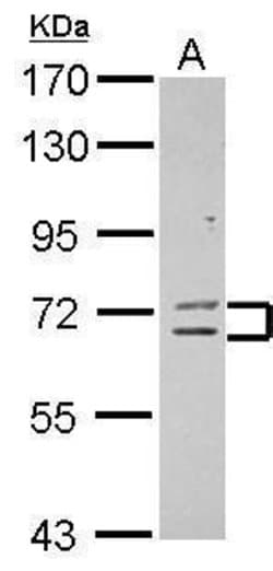 Invitrogen ZNF182 Polyclonal Antibody 100 &mu;L; Unconjugated:Antibodies,