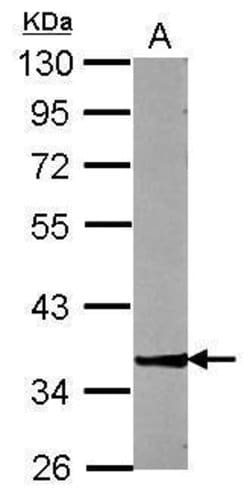 Invitrogen ZNF396 Polyclonal Antibody 100 &mu;L; Unconjugated:Antibodies,
