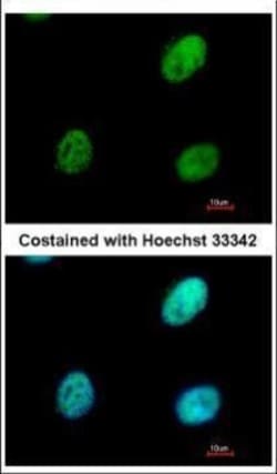Invitrogen RALY Polyclonal Antibody 100 &mu;L | Buy Online | Invitrogen&trade; | Fisher Scientific
