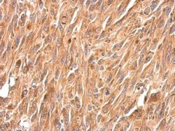 Invitrogen Periplakin Polyclonal Antibody 100 &mu;L; Unconjugated:Antibodies,