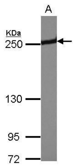 Invitrogen Periplakin Polyclonal Antibody 100 &mu;L; Unconjugated:Antibodies,