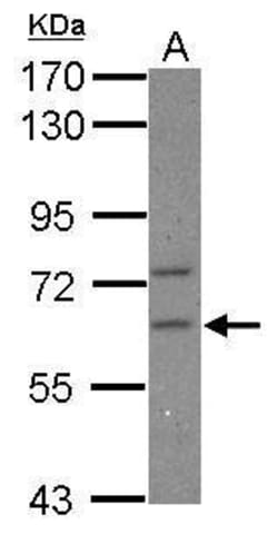 Invitrogen&trade;&nbsp;CPEB2 Polyclonal Antibody